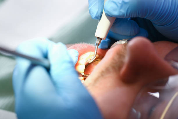 Best Emergency Dental Care for Abscessed Tooth in Tellico Plains, TN